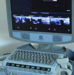 Ultraschallgerät in der Praxis